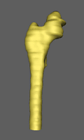 Reconstructed femur
